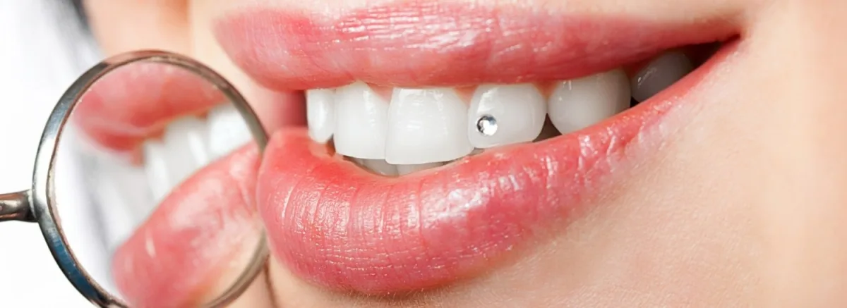 طب الأسنان التجميلي