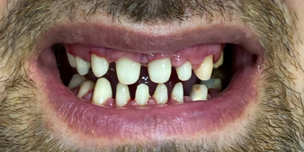 Before Image