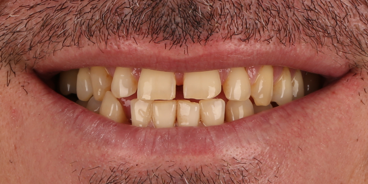Before Image