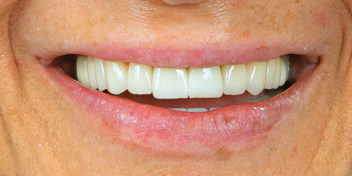 After Image