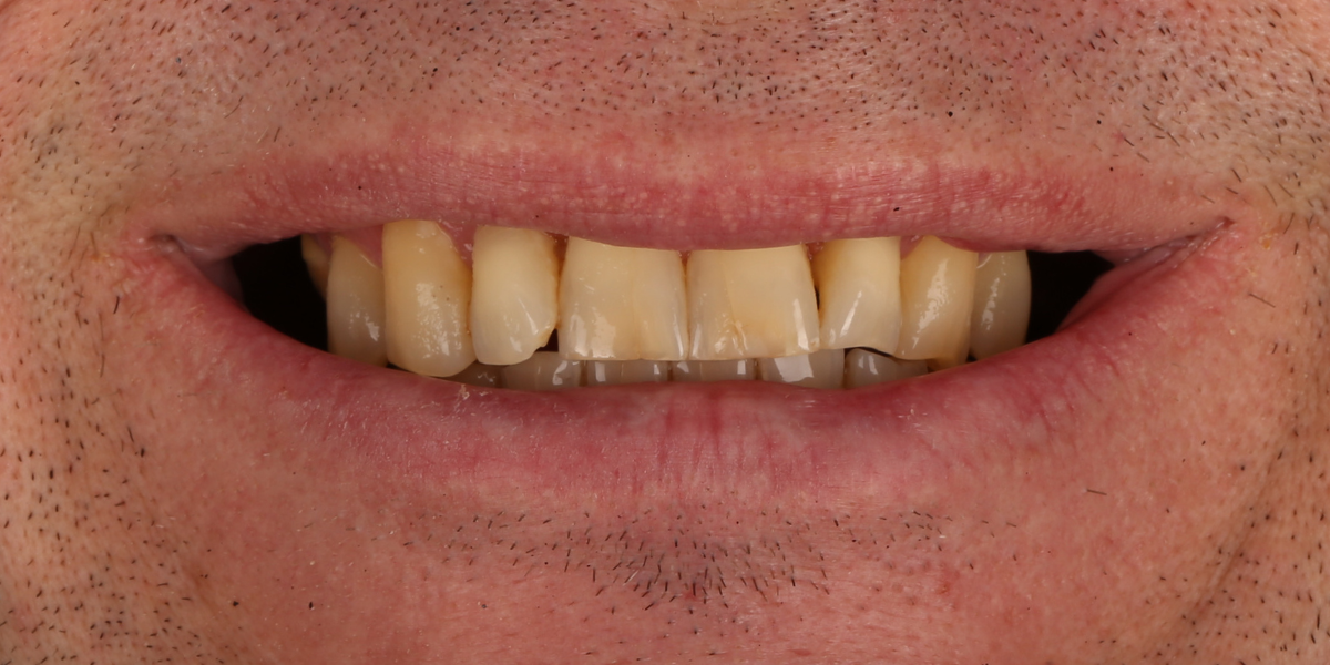 Before Image