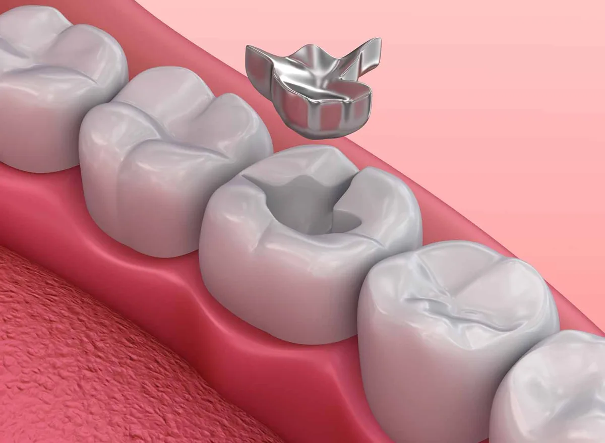 Regenerative Endodontie